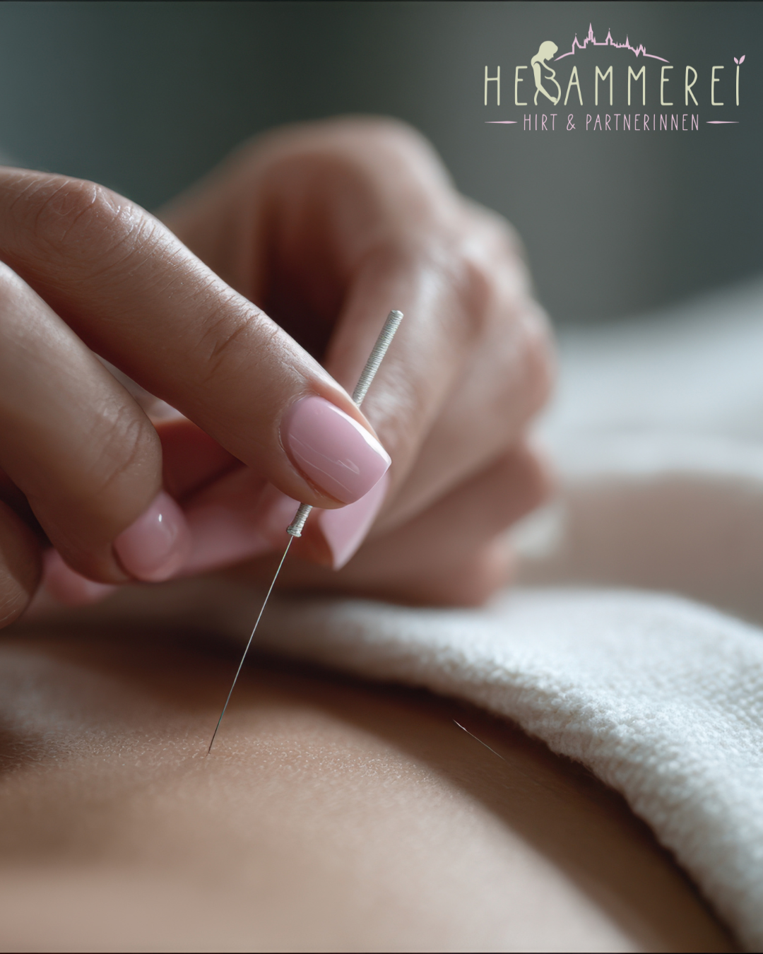 Geburtsvorbereitende Akupunktur